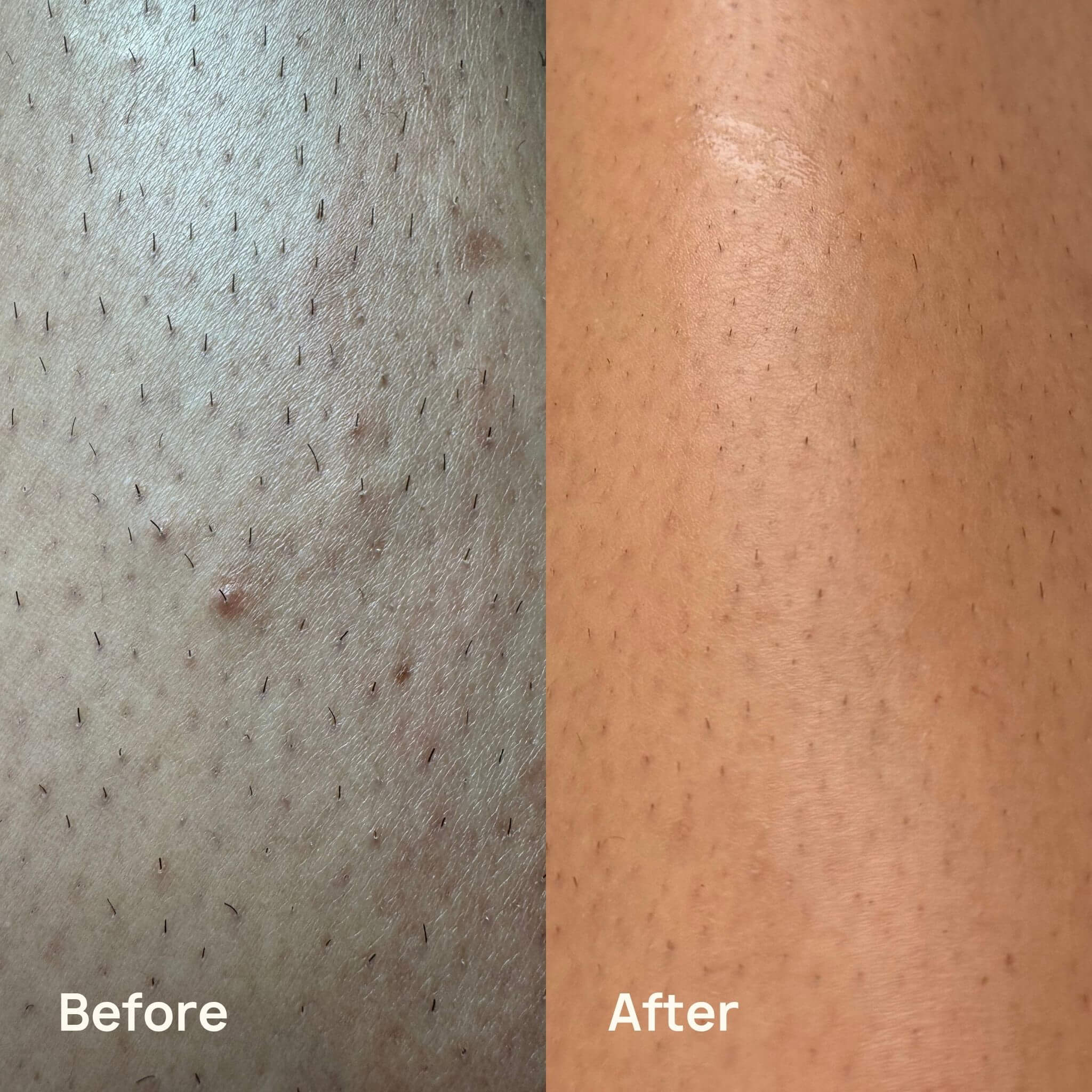 Before and after results using the Boosh trimmer on sensitive skin